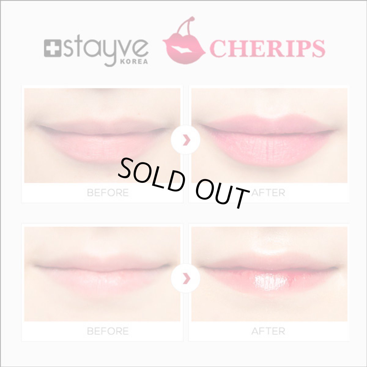 画像5: Stayve Cherips Micro-needling Ampoules Set for Lips  ステイヴ チェリップス リップ用 カラー材 (5)