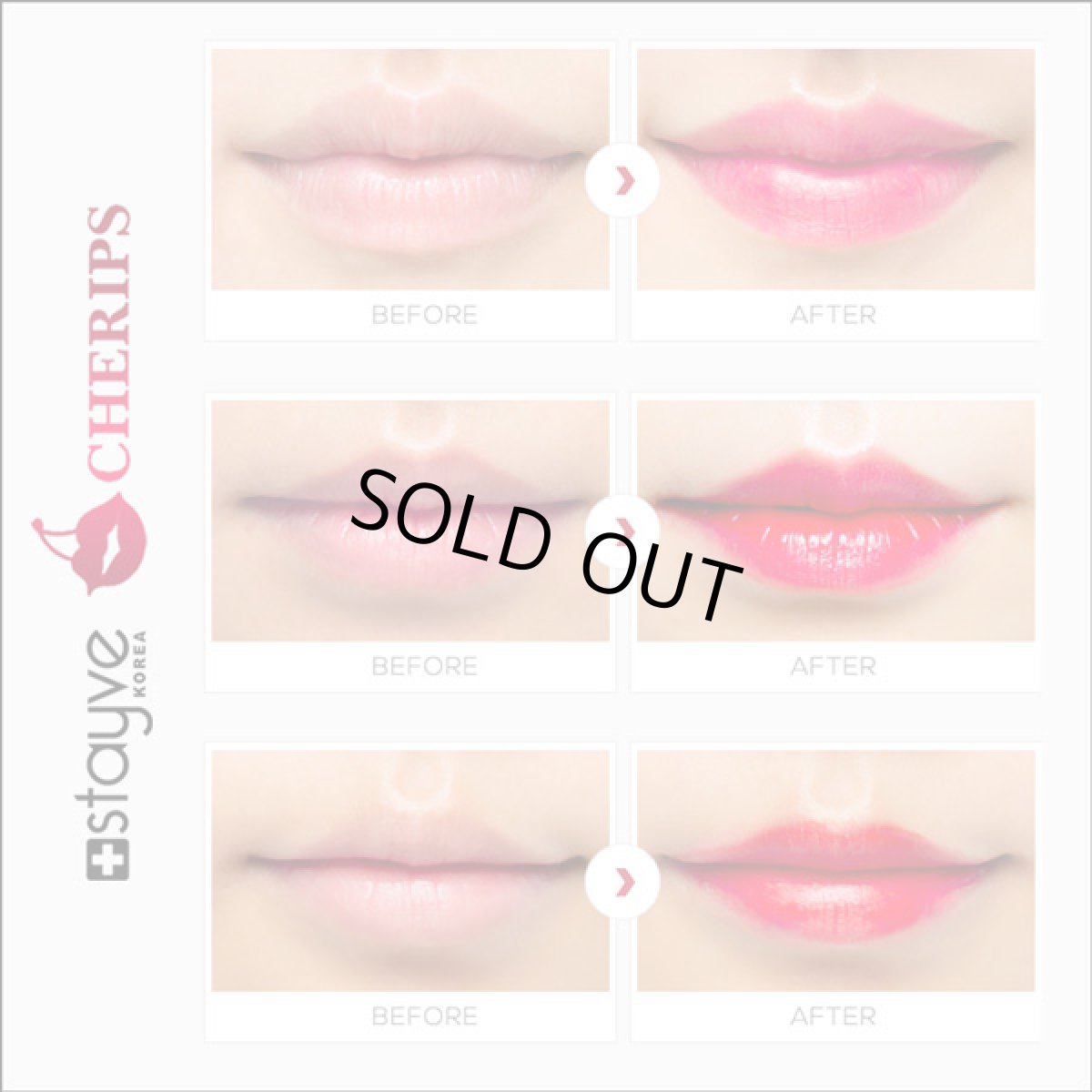 画像6: Stayve Cherips Micro-needling Ampoules Set for Lips  ステイヴ チェリップス リップ用 カラー材 (6)